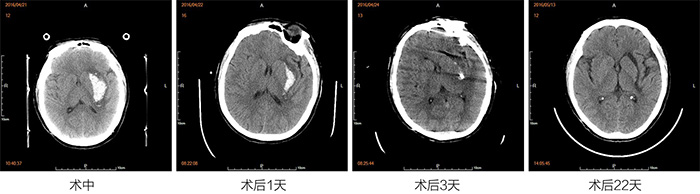 东北国际医院神经外科